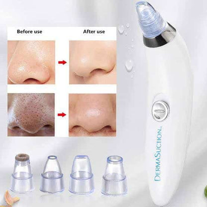 Derma suction Blackhead Remover Vacuum Acne Cleaner Black